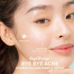 seoul-white-korea-bye-bye-acne-zit-zapper-invisible-hydrocolloid-pimple-patch_103109